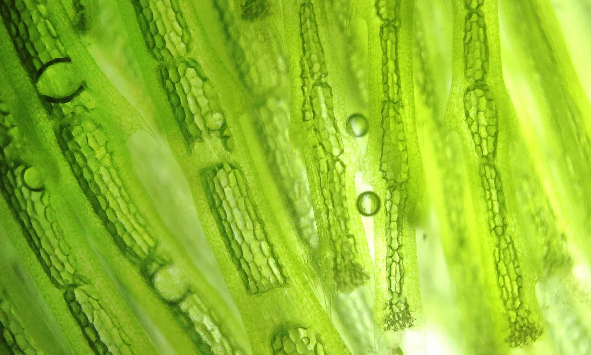Mikroskopische Aufnahme Mikroskopische Aufnahme von grünen Pflanzenzellen mit Chloroplasten